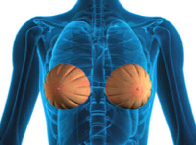 UK Surgeon Breast Surgeons